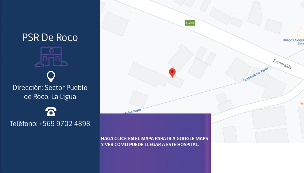 posta-de-roco-la-ligua