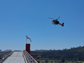 Exitoso trasplante de corazón traído vía aérea desde la Región Metropolitana